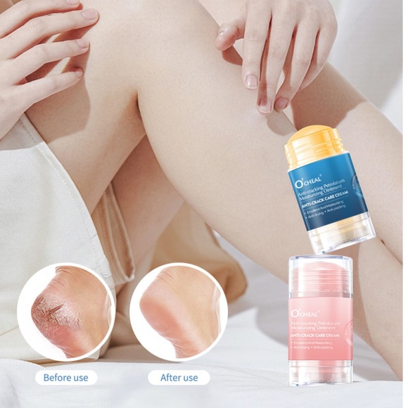 2 PCS Anti-Cracking Repair Cream stick - Picture 2 of 8